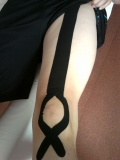 Kineziotaping